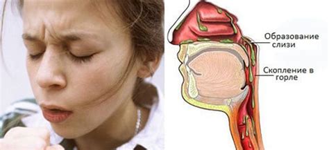 Причины появления желтой слизи утром в носоглотке