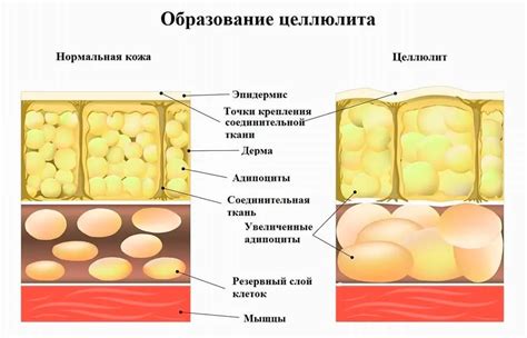 Причины появления эйрины