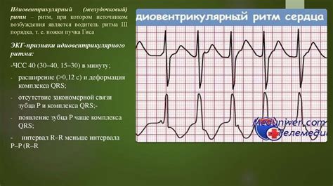 Причины синусовой аритмии