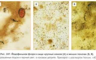 Причины формирования йодофильной флоры