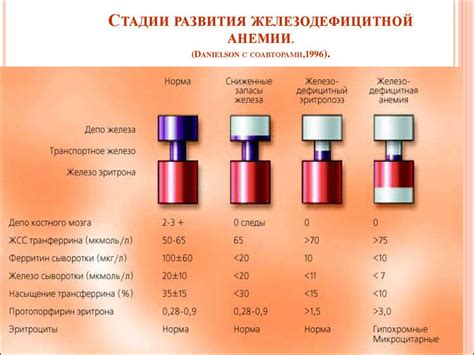 При железодефицитной анемии