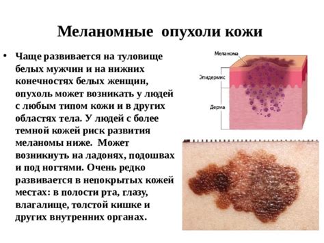 Проблематика мерзнущей кожи на конечностях в бане