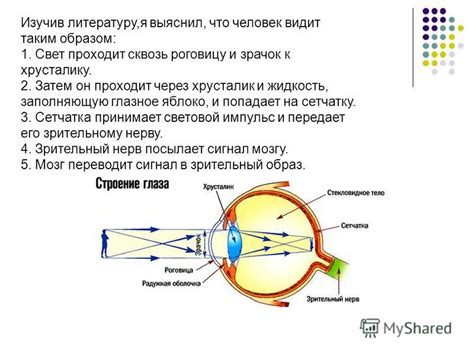 Проблемы в области зрительного восприятия