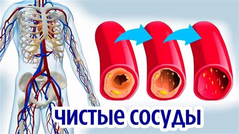 Проблемы сосудов и их очищение