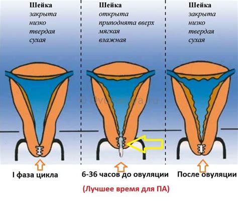 Проблемы шейки матки