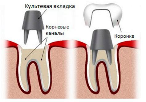 Проверка состояния зуба и коронки