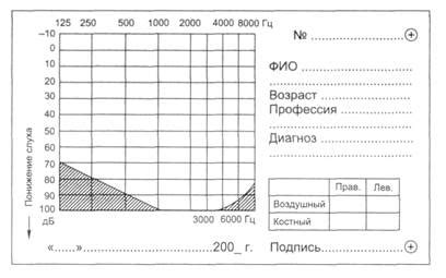 Проводимость звука через кости