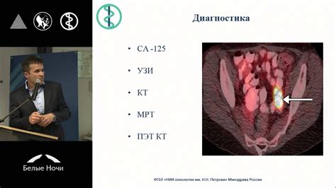 Прогноз и профилактика канцероматоза брюшины