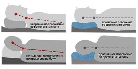 Продолжительное неправильное положение головы