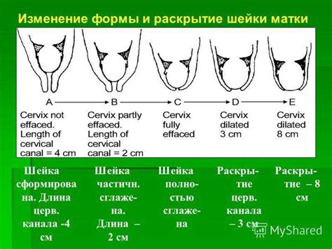 Продукты, способствующие готовности шейки матки