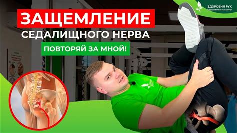 Простые упражнения для проверки и снятия защемления седалищного нерва