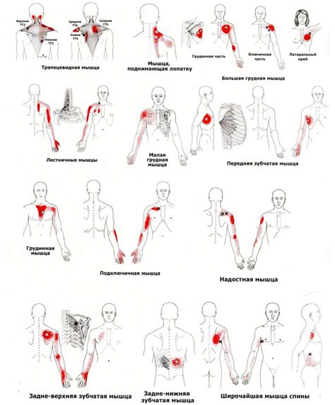 Профессиональное массажирование триггерных точек