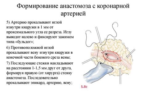 Профессиональные методы лечения хтэи