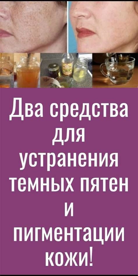 Профессиональные средства для устранения пятен