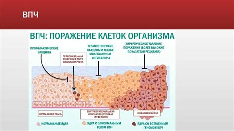 Профилактика ВПЧ и рекомендации для женщин