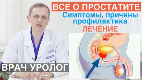 Профилактика воспаления простаты