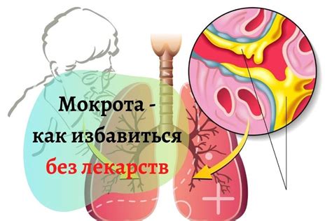 Профилактика густой мокроты: рекомендации от специалистов