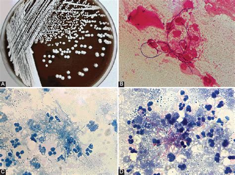 Профилактика заражения Nocardia spp