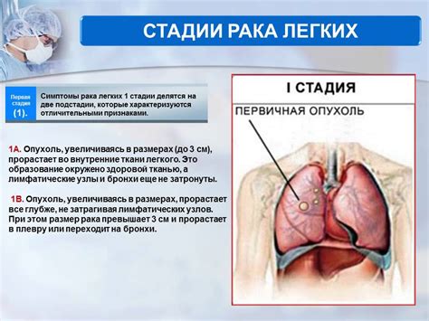 Профилактика неравномерной пневматизации легких