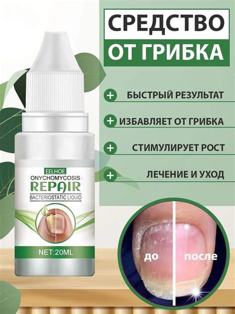 Профилактика отрывания ногтей