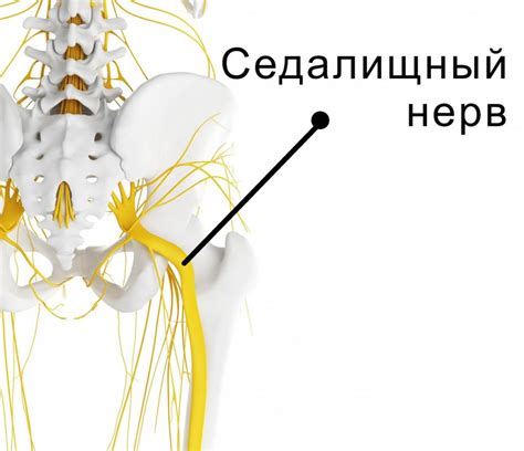 Профилактика повреждения седалищного нерва