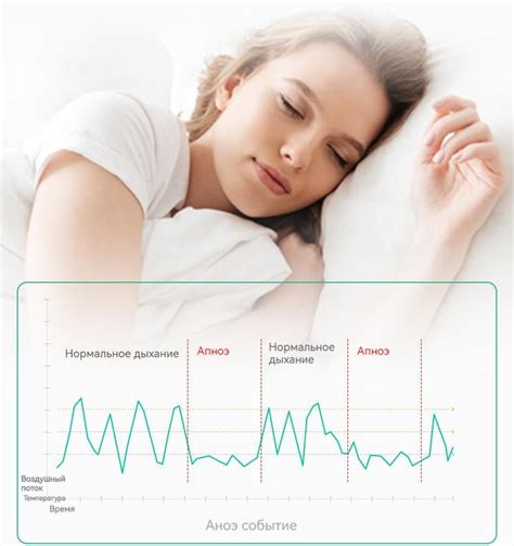 Профилактика прекращения дыхания во время сна