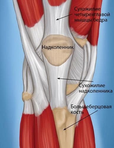 Профилактика связанных с разрывом связок проблем