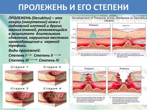 Профилактика слизи под кожей