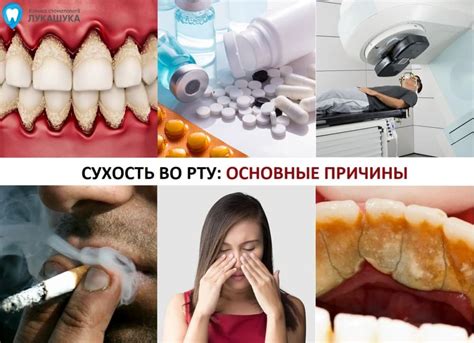 Профилактика сухости во рту и затруднения дыхания