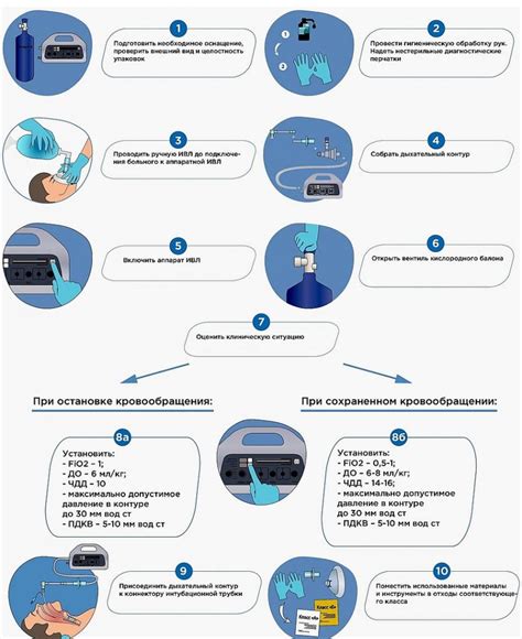 Процедура подключения пациента к аппарату ИВЛ 4 40
