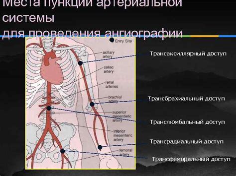 Процедура проведения ангиографии БЦА