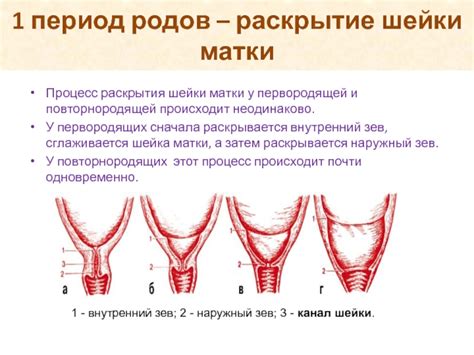 Процесс раскрытия шейки матки