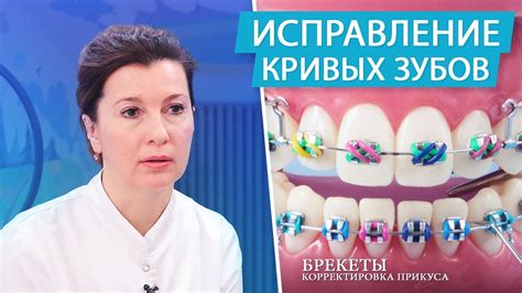 Психологические аспекты снов о брекетах