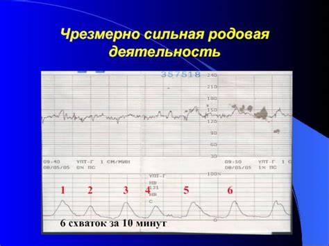 Развитие патологий при низких эпизодах на КТГ