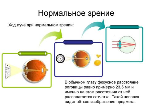 Раздел "Зрение" и "Голосовое сопровождение"