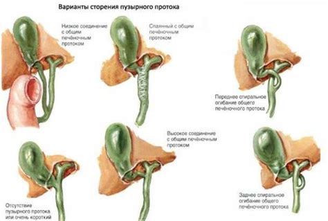 Раздел 2: Симптомы ненормальной работы желчного пузыря