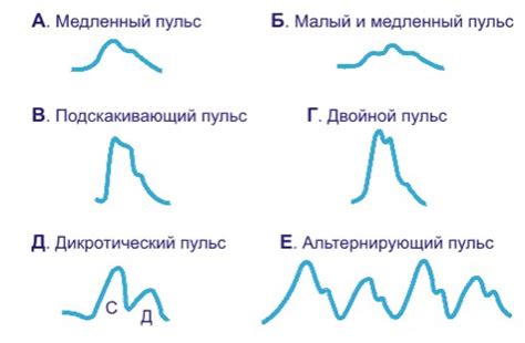 Различные виды повышенного пульса