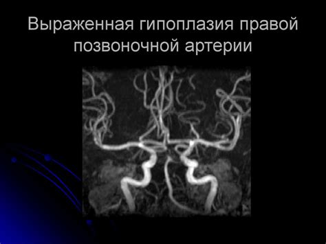 Разнородные причины возникновения гипоплазии правой полушарии головного мозга