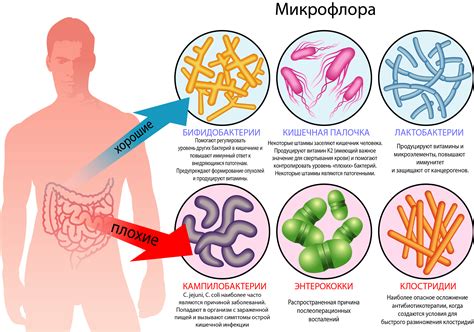 Расстройство микрофлоры кишечника и его последствия