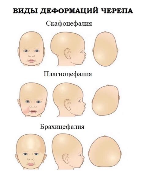 Расчет размеров и формы головы кота