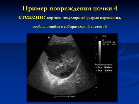 Расчет степени повреждения системы