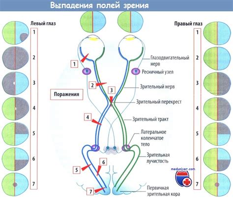 Расширение зрачков и нарушение зрения