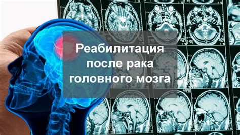 Реабилитация после гипотрофических изменений головного мозга