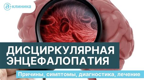 Реабилитация после лечения Дэ 2 степени смешанного генеза