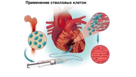 Регенеративная медицина: применение стволовых клеток