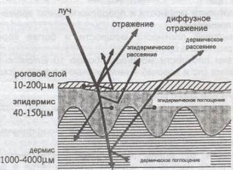 Результаты воздействия лазерного луча на экран