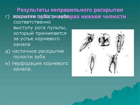 Результаты неправильного омовения в посте