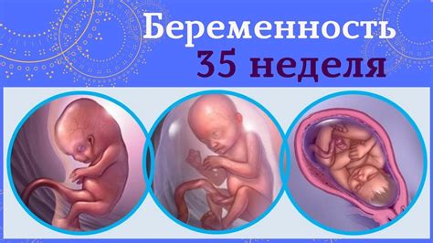 Рекомендации для беременных на 35 неделе