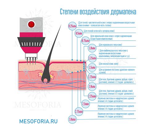 Рекомендации по уходу за волосами после фракционной мезотерапии