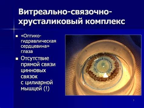 Рисование основных элементов глаза